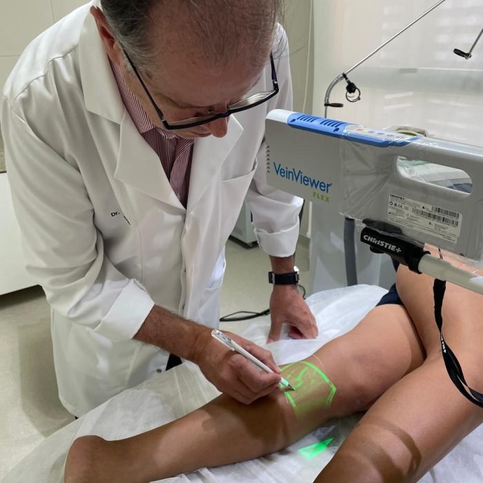 CURSO LASER